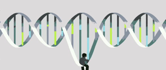 Síndrome Prader Willi