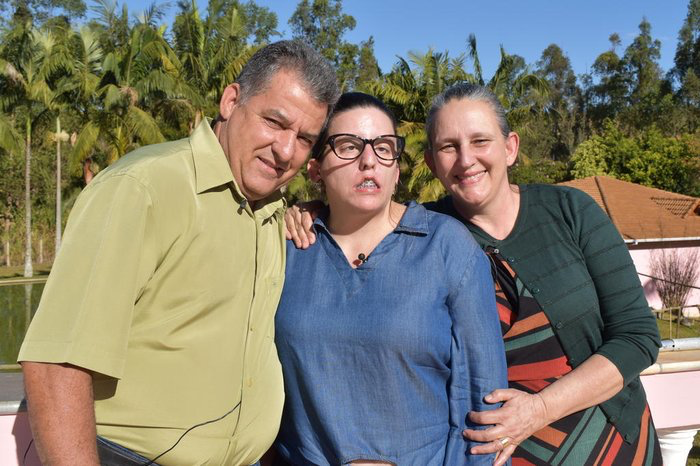 Síndrome de Moebius: Parálisis facial congénita