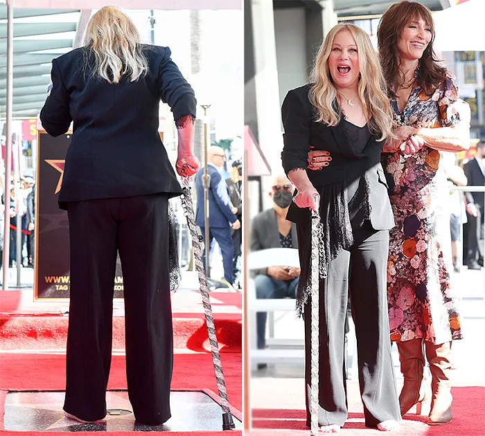 Christina Applegate y esclerosis múltiple: ¿Cómo afrontar el diagnóstico?