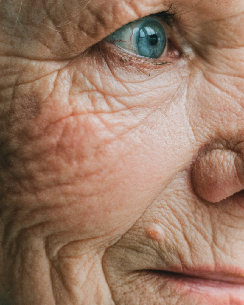 Estrés crónico y Alzheimer 