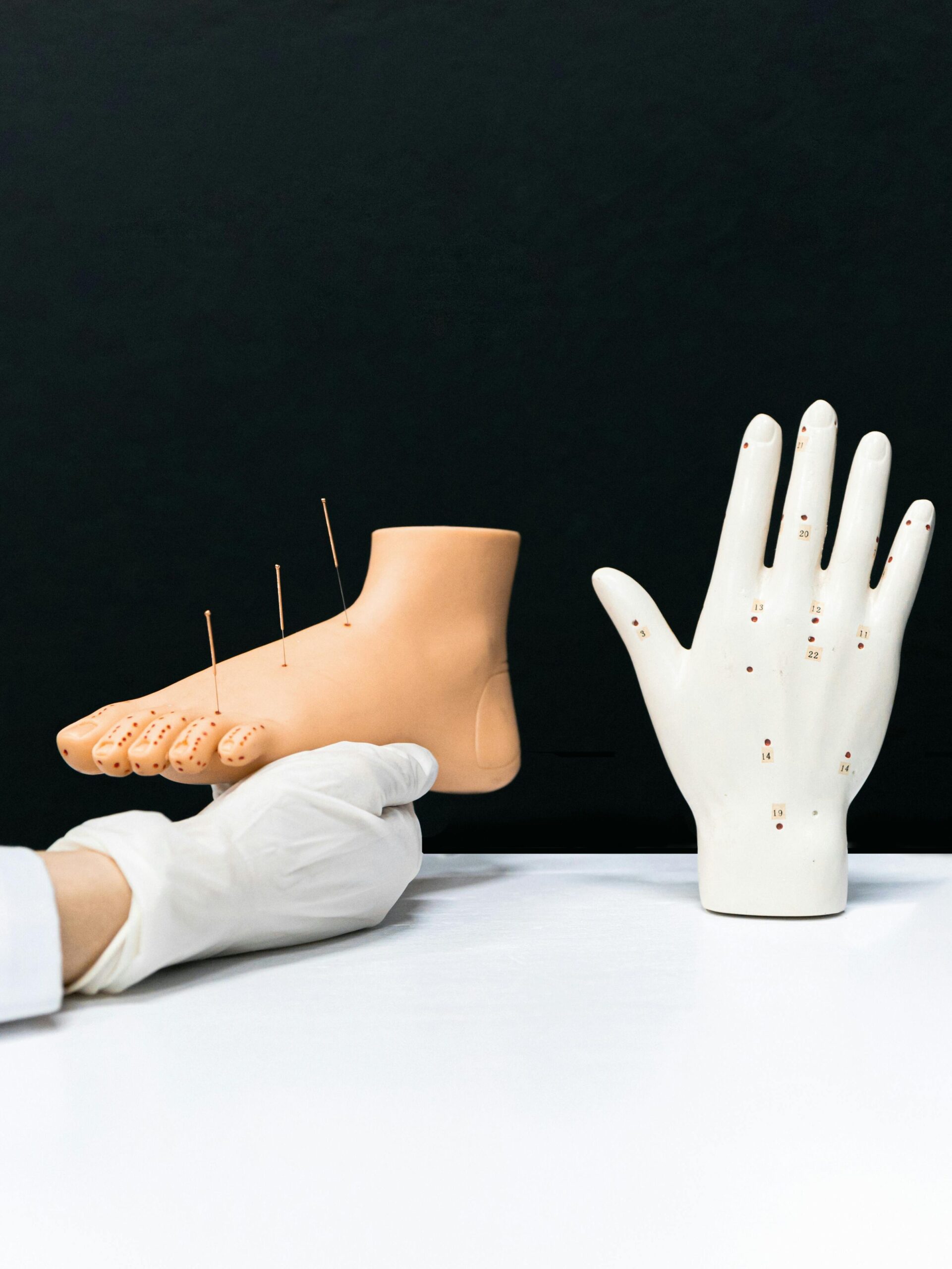 acupuntura cerebro terapia alternativa