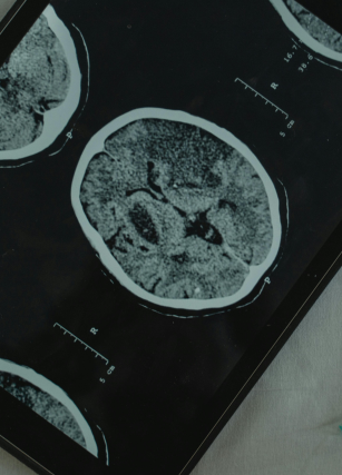 Regulación emocional y cerebro