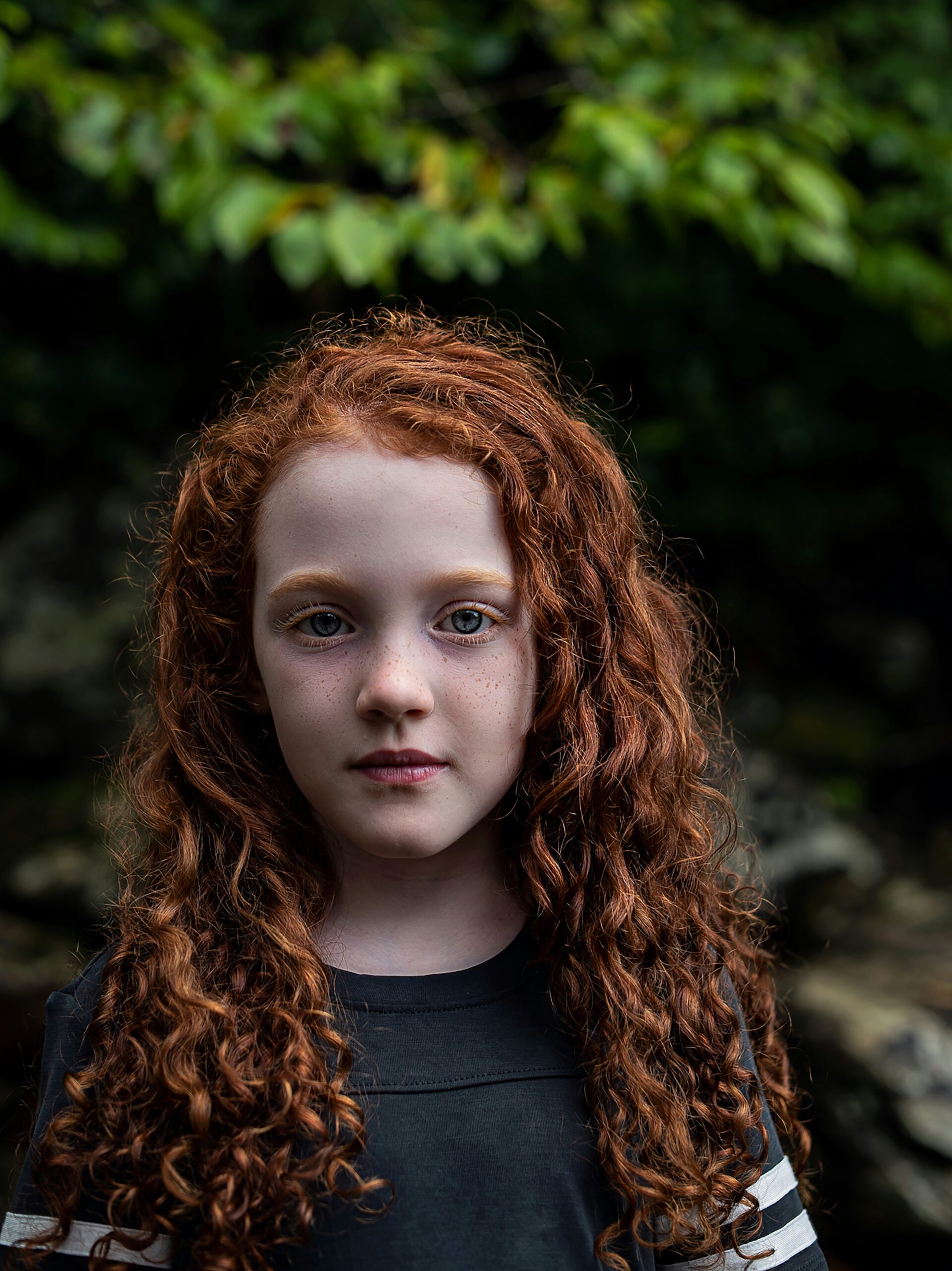 TCC, TOC infantil, Terapia combinada, farmacológico