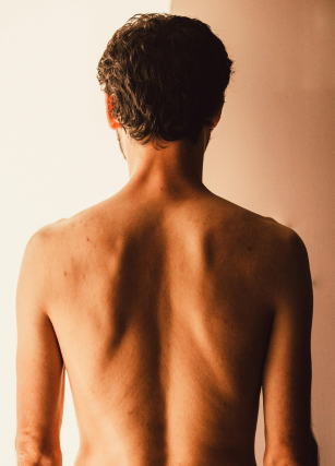 alimentación y vergüenza